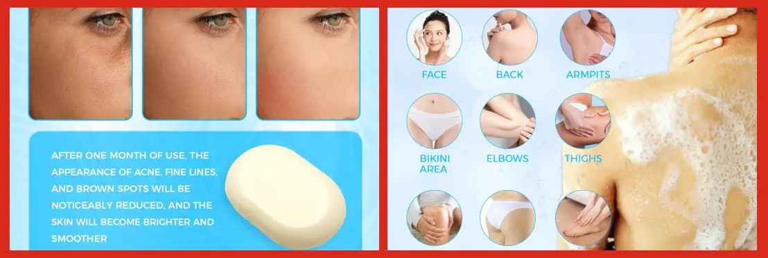 Mejores Jabones para Eliminar el Acné Recomendados por Dermatólogos